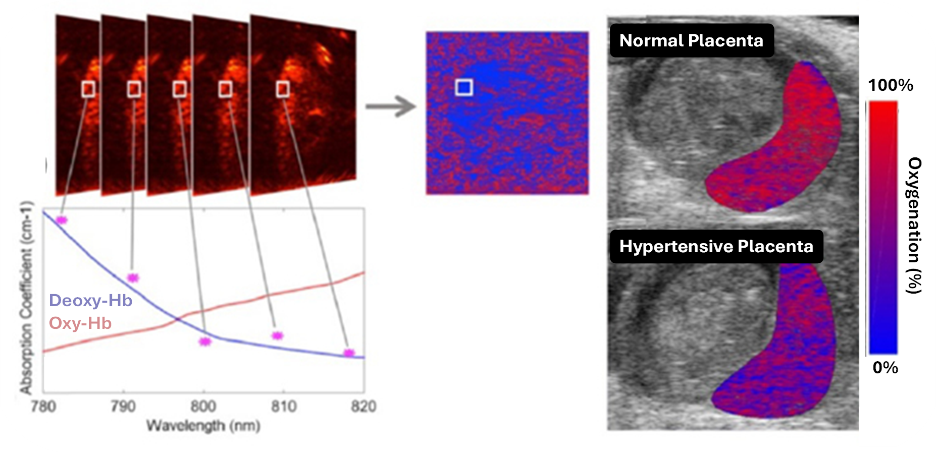 Photoacoustic Imaging of placenta
