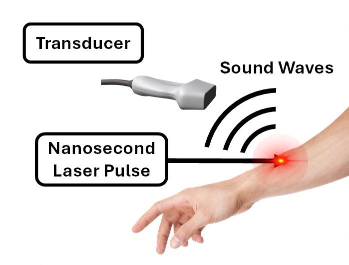 Photoacoustic Imaging Schematic